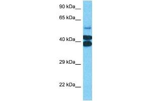 Image no. 3 for anti-Prostate Tumor Overexpressed 1 (PTOV1) (N-Term) antibody (ABIN2784251)
