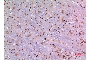 Image no. 4 for anti-Mesencephalic Astrocyte-Derived Neurotrophic Factor (MANF) (Internal Region) antibody (ABIN3187826)