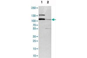 Image no. 4 for anti-Diaphanous Homolog 2 (DIAPH2) antibody (ABIN5576602)