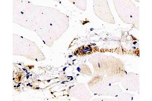 Immunohistochemistry analysis of paraffin-embedded mouse skeletal muscle using DLL4 Polyclonal Antibody at dilution of 1:200.