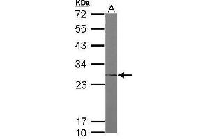 Image no. 2 for anti-FK506 Binding Protein 3, 25kDa (FKBP3) (Center) antibody (ABIN2856136)
