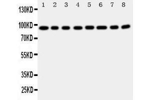 Image no. 1 for anti-Coagulation Factor VIII (F8) (AA 1264-1278), (Middle Region) antibody (ABIN3042924)