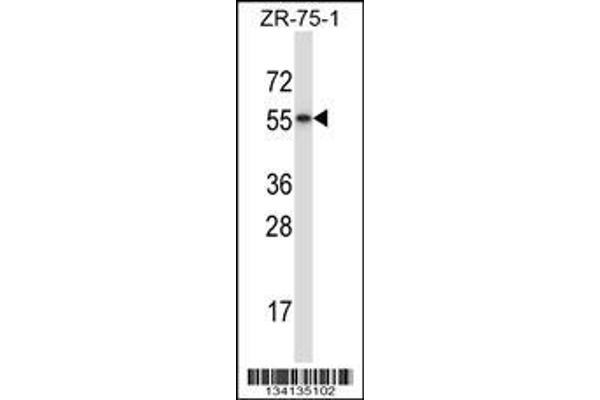 anti-RAR-Related Orphan Receptor B (RORB) (AA 329-358), (C-Term) antibody