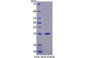 Image no. 1 for Dual Specificity Phosphatase 5 (DUSP5) (AA 1-135) protein (T7 tag,His tag) (ABIN6237142)