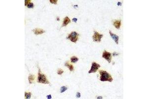 Image no. 1 for anti-ELAV-Like 3 (ELAVL3) antibody (ABIN2966734)