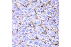 Image no. 4 for anti-Major Histocompatibility Complex, Class I, A (HLA-A) antibody (ABIN3023100)