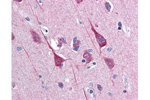 Image no. 2 for anti-Disrupted in Schizophrenia 1 (DISC1) (C-Term) antibody (ABIN337350)