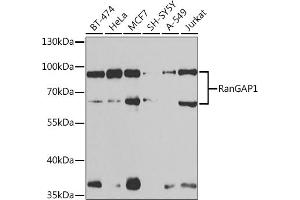 RANGAP1 Antikörper  (AA 398-587)