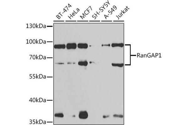 RANGAP1 Antikörper  (AA 398-587)