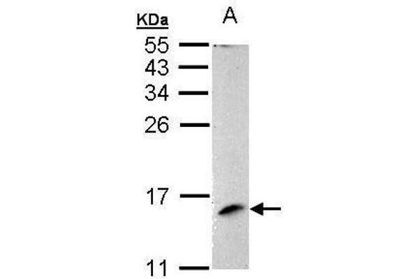 PITRM1 Antikörper  (full length)