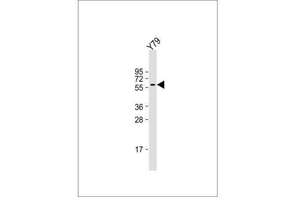 SLC5A12 anticorps  (C-Term)