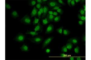 Image no. 1 for anti-Programmed Cell Death 6 (PDCD6) (AA 92-191) antibody (ABIN2866332)
