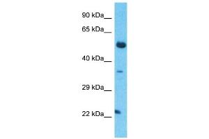 TCEAL5 antibody  (Middle Region)