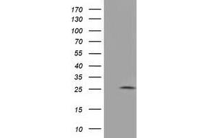 Image no. 3 for anti-Adenylate Kinase 3 (AK3) antibody (ABIN2715740)