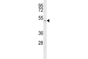 Image no. 1 for anti-Solute Carrier Family 16, Member 1 (Monocarboxylic Acid Transporter 1) (SLC16A1) (AA 430-460) antibody (ABIN3028819)
