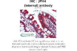 Image no. 3 for anti-Junctophilin 4 (JPH4) (Internal Region) antibody (ABIN1736134)
