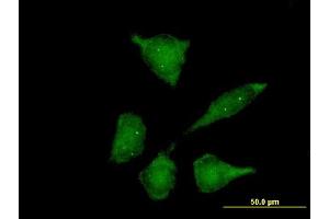 Image no. 2 for anti-Gem (Nuclear Organelle) Associated Protein 2 (GEMIN2) (AA 1-280) antibody (ABIN521936)