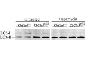 Image no. 5 for anti-Microtubule-Associated Protein 1 Light Chain 3 beta (MAP1LC3B) (AA 1-30), (N-Term) antibody (ABIN5555711)