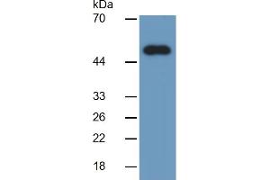 Image no. 6 for Growth Differentiation Factor 2 (GDF2) ELISA Kit (ABIN6730862)
