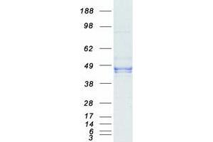 Image no. 1 for Dual Specificity Phosphatase 6 (DUSP6) (Transcript Variant 1) protein (Myc-DYKDDDDK Tag) (ABIN2719840)