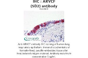 Image no. 2 for anti-Armadillo Repeat Gene Deleted in Velocardiofacial Syndrome (ARVCF) (AA 863-963) antibody (ABIN1723436)
