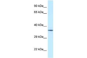 Image no. 1 for anti-Nudix (Nucleoside Diphosphate Linked Moiety X)-Type Motif 6 (NUDT6) (Middle Region) antibody (ABIN2789004)