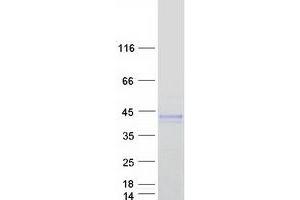 Image no. 1 for ADP-Ribosyltransferase 5 (ART5) (Transcript Variant 2) protein (Myc-DYKDDDDK Tag) (ABIN2714950)
