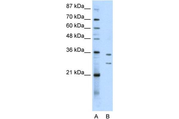 anti-Brix Domain Containing 5 (RPF1) (N-Term) antibody