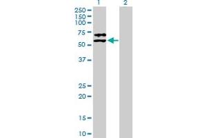 Image no. 1 for anti-Alpha2 Antiplasmin (SERPINF2) (AA 1-491) antibody (ABIN518962)