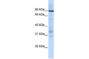 Image no. 1 for anti-Ewing Sarcoma Breakpoint Region 1 (EWSR1) (Middle Region) antibody (ABIN2780666)