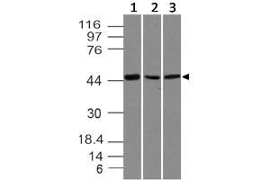 Image no. 1 for anti-SRY (Sex Determining Region Y)-Box 11 (SOX11) (AA 23-236) antibody (ABIN5027535)