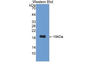 Image no. 2 for anti-Phospholipid Transfer Protein (PLTP) (AA 337-479) antibody (ABIN1869874)