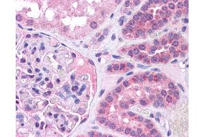 Image no. 3 for anti-V-Maf Musculoaponeurotic Fibrosarcoma Oncogene Homolog (Avian) (MAF) (N-Term) antibody (ABIN6745717)