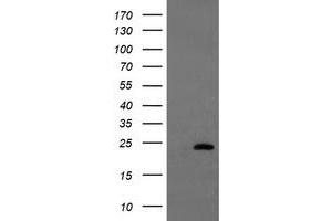 Image no. 7 for anti-Ubiquitin-Conjugating Enzyme E2E 3 (UBE2E3) antibody (ABIN1501618)