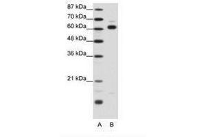 Image no. 1 for anti-Thyroid Hormone Receptor Interactor 4 (TRIP4) (AA 191-240) antibody (ABIN202787)