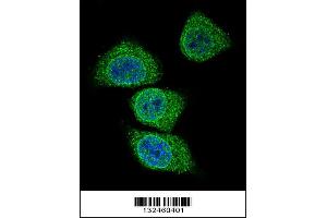Image no. 1 for anti-Gastric Intrinsic Factor (Vitamin B Synthesis) (GIF) (AA 189-218) antibody (ABIN656899)
