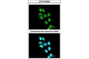 Image no. 2 for anti-Inositol Hexakisphosphate Kinase 2 (IP6K2) (AA 15-200) antibody (ABIN467499)