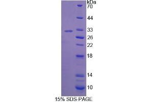 Image no. 1 for BCL6 Co-Repressor (BCOR) (AA 1553-1755) protein (His tag) (ABIN6238837)
