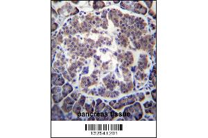Image no. 1 for anti-Transducin (Beta)-Like 2 (TBL2) (AA 43-72), (N-Term) antibody (ABIN656760)
