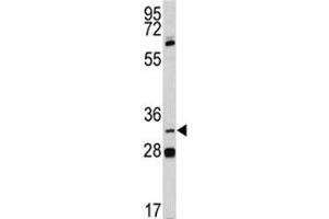 Image no. 4 for anti-Paired-Like Homeodomain 1 (PITX1) (AA 123-150) antibody (ABIN3032139)