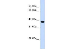 Image no. 1 for anti-Acyl-CoA Binding Domain Containing 4 (ACBD4) (N-Term) antibody (ABIN1105203)