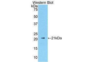 Image no. 1 for anti-Sex Hormone Binding Globulin (SHBG) (AA 219-358) antibody (ABIN1172838)