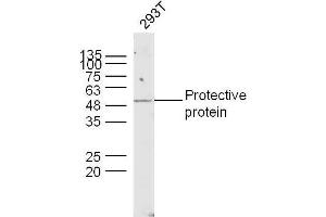 Image no. 1 for anti-Cathepsin A (CTSA) (AA 401-480) antibody (ABIN2178715)