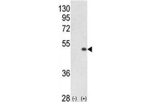 anti-Cyclin-Dependent Kinase 16 (CDK16) (AA 357-386) antibody