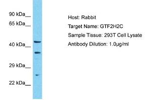 Image no. 1 for anti-General Transcription Factor IIH, Polypeptide 2C (GTF2H2C) (N-Term) antibody (ABIN2792028)