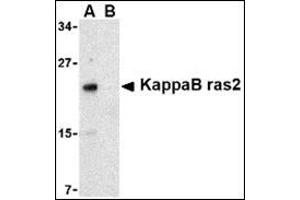 Image no. 1 for anti-NFKB Inhibitor Interacting Ras-Like 2 (NKIRAS2) (C-Term) antibody (ABIN500114)