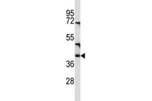 Image no. 1 for anti-T-cell surface glycoprotein CD1c (CD1C) (AA 226-253) antibody (ABIN3030368)