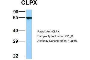 Image no. 3 for anti-ClpX Caseinolytic Peptidase X (CLPX) (C-Term) antibody (ABIN2789497)