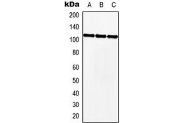 MKL2 抗体  (Center)