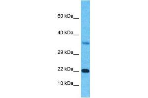 Image no. 1 for anti-Synovial Sarcoma, X Breakpoint 3 (SSX3) (Middle Region) antibody (ABIN5516643)